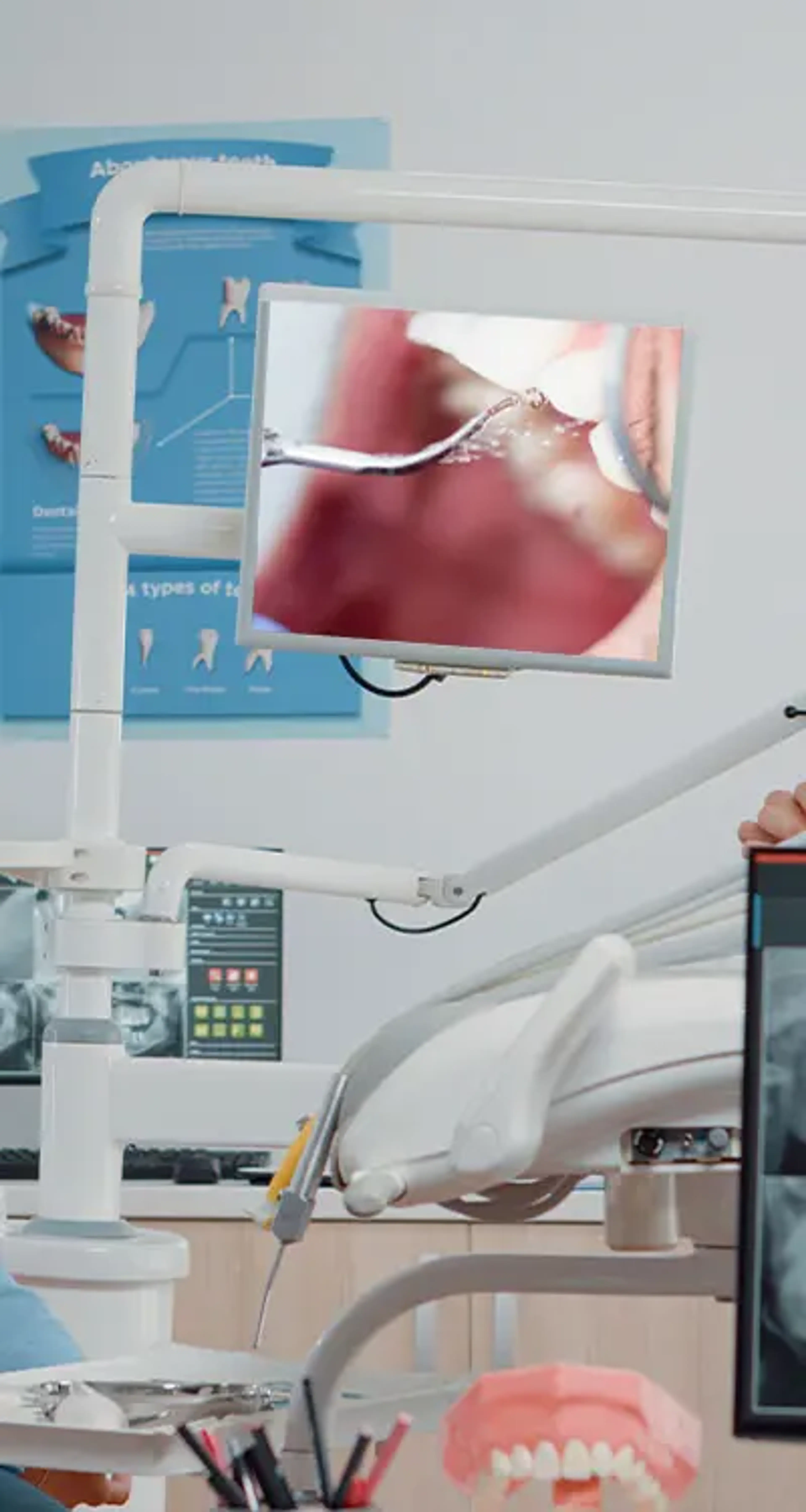 Intraoral Cameras