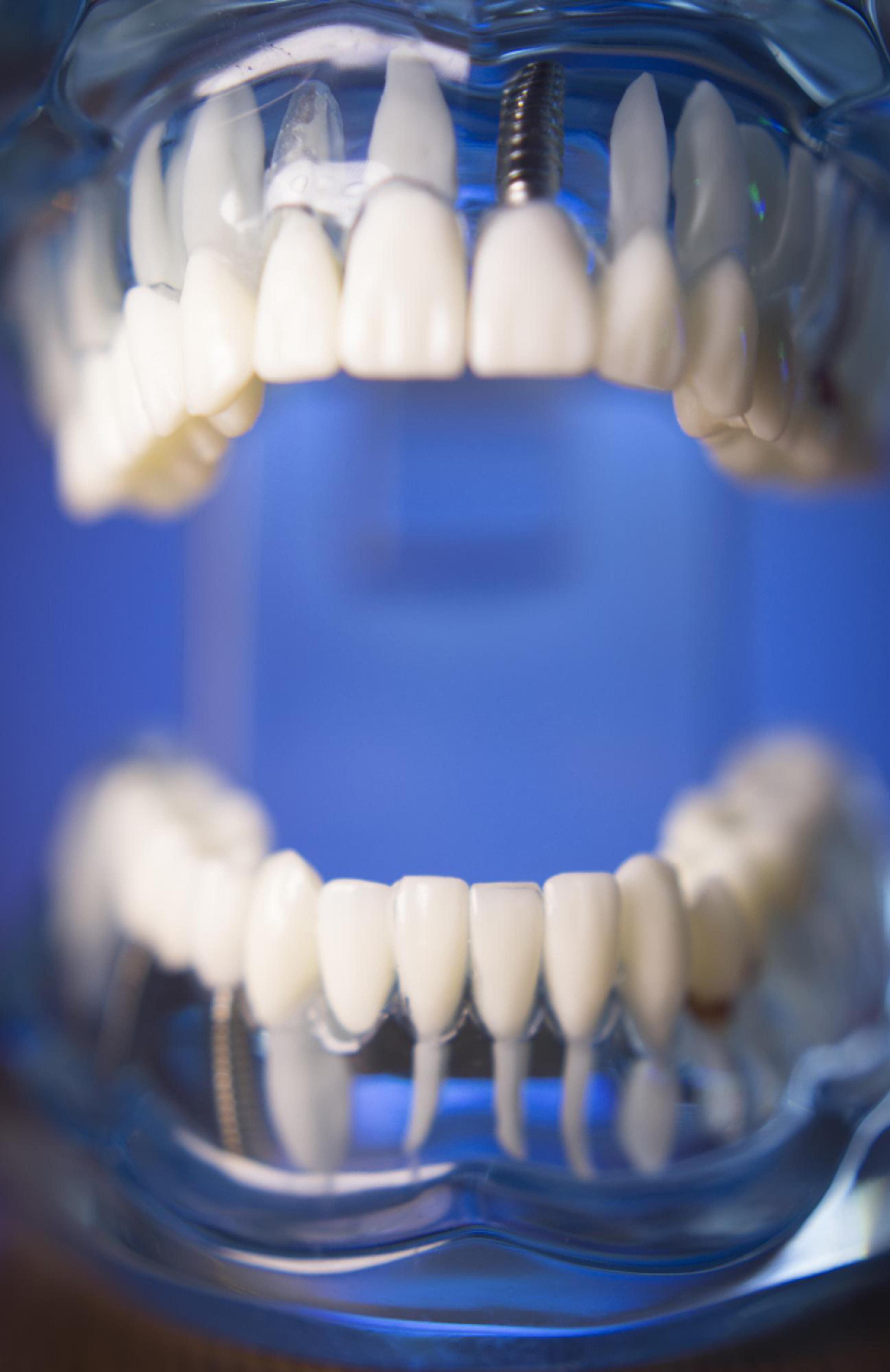 Teeth
